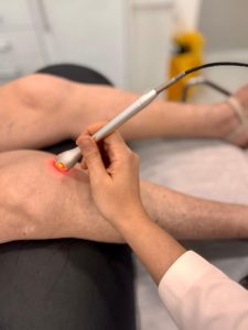Terapie cu laser pentru genunchi: soluția modernă pentru durerea articulară