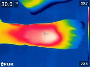 termografie cu laser