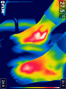 termografie picioare