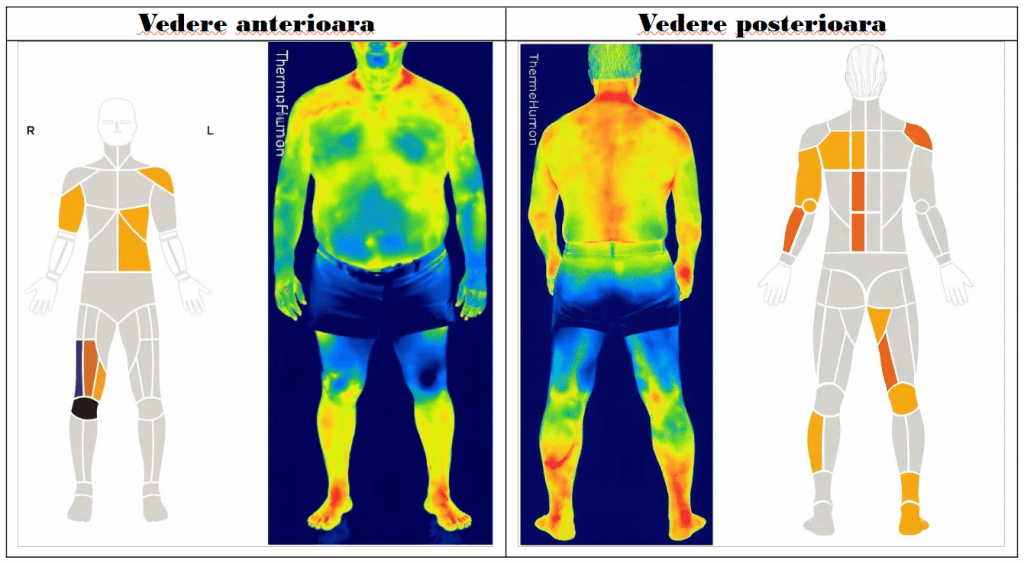 lanț cinematic afectat integral