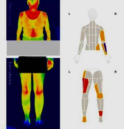 preventie prin reechilibrare