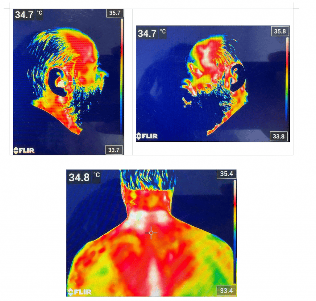 termografie din 3 parti